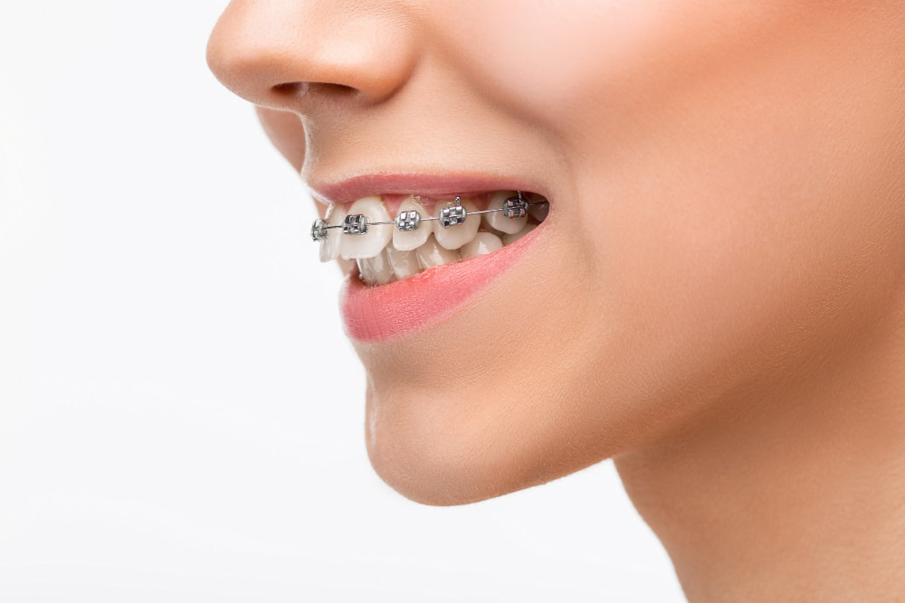 Henderson orthodontics